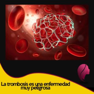 dieta para la trombosis y alimentos para evitar la trombosis
